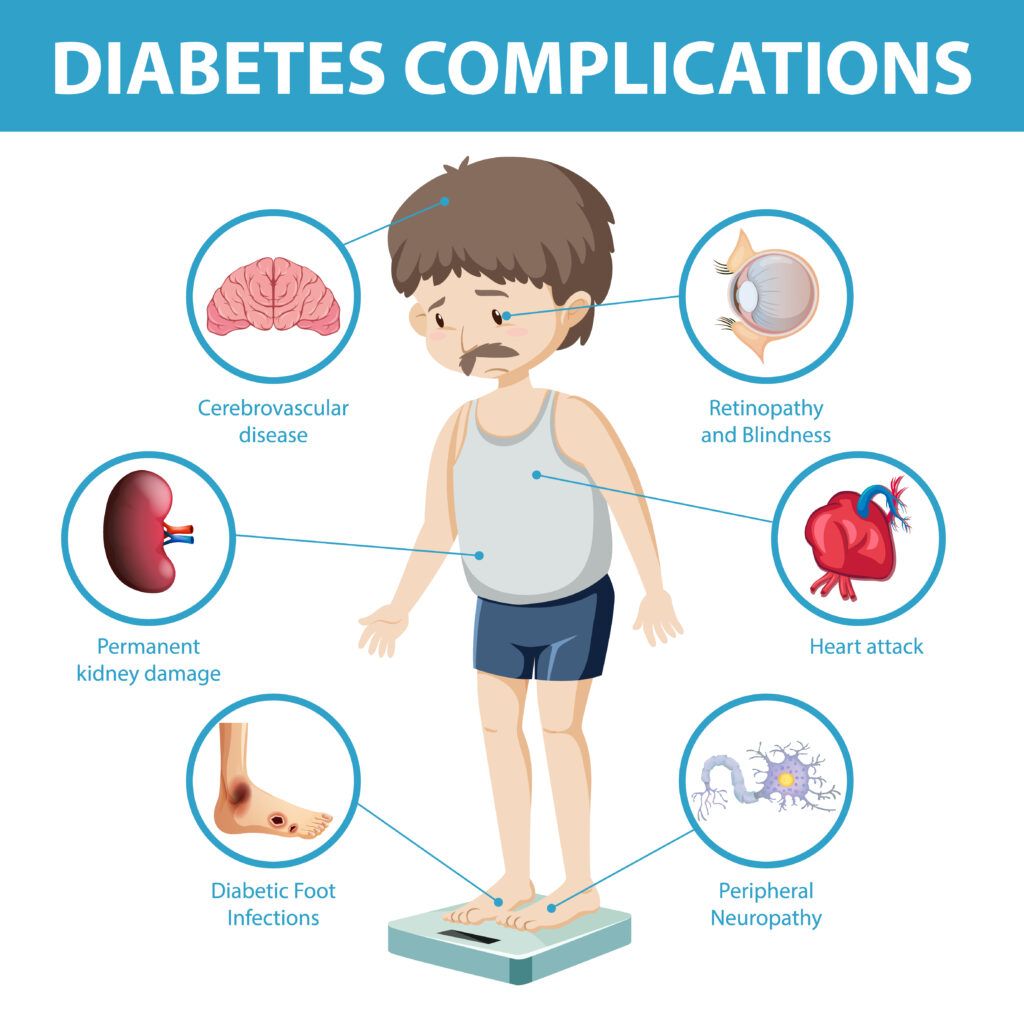 komplikasi diabetes melitus